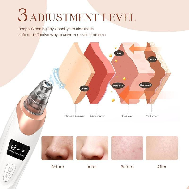 Electric Blackhead Remover Set, 1 Box Multifunctional Facial Pore Cleaner and 5 Probes, USB Rechargeable, Vacuum Facial Pore Cleaner, Facial Beauty Instrument for Women & Men,Ease of Use